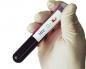 Tes HIV menggunakan metode PCR: kapan harus dilakukan, bagaimana keakuratan diagnosis PCR untuk infeksi terkait HIV