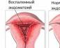 Endometrit nedir ve nasıl tedavi edilir