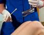 Klasyczne objawy zapalenia błony śluzowej macicy u kobiet i skuteczne taktyki leczenia