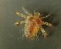 Pediculosis pubis (phthiriasis) Intimate lice