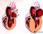 Ako posilniť svaly srdca a ciev