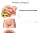 Chlamydia in women, chlamydia: symptoms, diagnosis and treatment in Pyatigorsk Chlamydia preventive measures