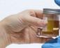 Hva indikerer økt surhet i urinen?